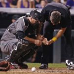 Arizona Diamondbacks catcher Chris Iannetta has his left hand looked at by a trainer during the third inning of a baseball game against the Colorado Rockies, Friday, Sept. 1, 2017, in Denver. (AP Photo/Jack Dempsey)