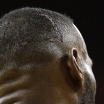 
              A wound is seen on the head Cleveland Cavaliers forward LeBron James (23) during the second half of Game 4 of basketball's NBA Finals against the Golden State Warriors in Cleveland, Thursday, June 11, 2015. James was injured in the first half. The Golden State Warriors won 103-82. (AP Photo/Tony Dejak)
            