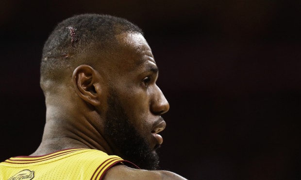 Blood shows on the head Cleveland Cavaliers forward LeBron James (23) during the second half of Gam...