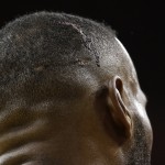 A wound is seen on the head Cleveland Cavaliers forward LeBron James (23) during the second half of Game 4 of basketball's NBA Finals against the Golden State Warriors in Cleveland, Thursday, June 11, 2015. James was injured in the first half. (AP Photo/Tony Dejak)